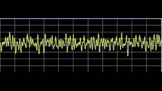 Brain Diseases  Rife Frequencies [upl. by Haila]