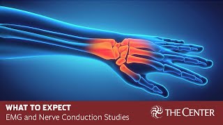 What to Expect During Nerve Conduction Studies and EMG Tests [upl. by Eitnom]