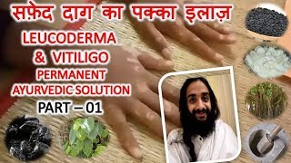 सफ़ेद दाग का पक्का इलाज़1 LEUCODERMA AND VITILIGO PERMANENT AYURVEDIC SOLUTION  PART  01 [upl. by Aryl824]