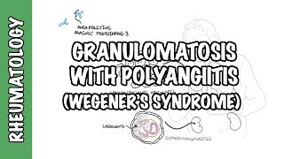 INFLAMMATION Part 9 Chronic Inflammation  GRANULOMATOUS INFLAMMATION [upl. by Oirramed264]