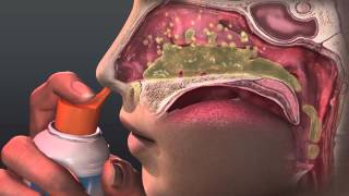 Can Saline Irrigation Help Nasal Allergies Animated Guide to Saline Nasal Irrigation [upl. by Alliuqet]