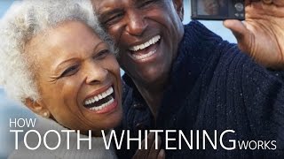 How Tooth Whitening Works [upl. by Shetrit763]