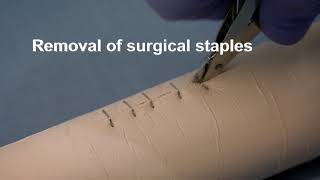 Placing and removing surgical wound closure staples [upl. by Euqinu]