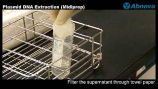 Plasmid DNA Extraction Midiprep [upl. by Devondra]