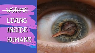 WORMS LIVING INSIDE HUMANS  EXPLAINED [upl. by Willard]