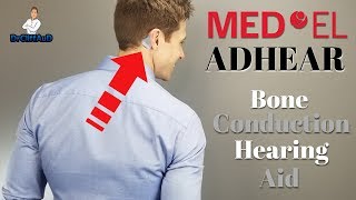 Newest Bone Conduction Hearing Aid  MedEL ADHEAR [upl. by Campball]