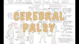 Cerebral Palsy  DETAILED Overview [upl. by Akeret]