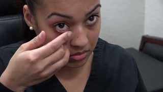 How to Apply Ointment to the Eyes and Eyelids [upl. by Gerda]