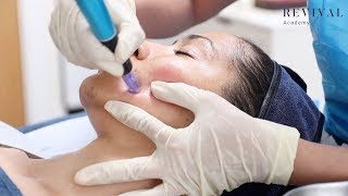 Microneedling Full Training Video [upl. by Samson272]