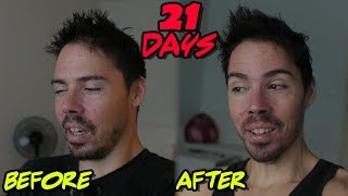 21 Day Water Fast What I Healed and What Id Do Different [upl. by Ateuqirne]