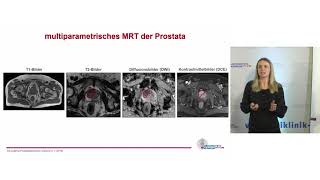 Diagnostik und Therapie beim Prostatakarzinom  Prof Dr Cordula Jilg [upl. by Nata726]