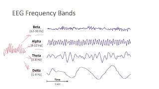 EEG Signal Processing [upl. by Naira645]