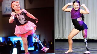 8YearOld Dances With Prosthetic Leg [upl. by Margaret]