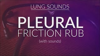 Pleural Friction Rub  Pleural Rub [upl. by Rufina]