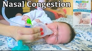 NASAL CONGESTION NEWBORNS [upl. by Etep]