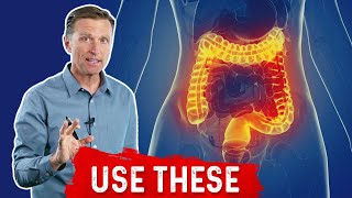 Diverticulitis Causes SIgns and Symptoms Diagnosis and Treatment [upl. by Vish34]