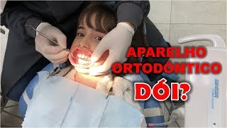 COLOCANDO APARELHO ORTODÔNTICO FIXO [upl. by Yrannav14]