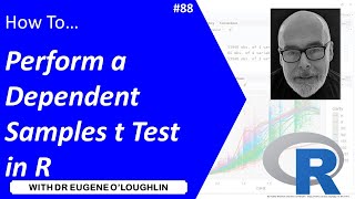 How To Perform a Dependent Samples t Test in R 88 [upl. by Ahsilrac519]