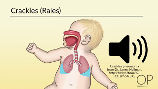 Respiratory Assessment by B Leary L DelSignore  OPENPediatrics [upl. by Kauppi600]