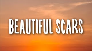 Maximillian  Beautiful Scars Lyrics [upl. by Steffy]