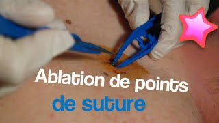 Ablation de points de suture [upl. by Olivier]