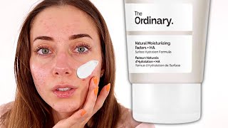 The Best Inexpensive Moisturizer  The Ordinary Natural Moisturizing Factors  HA Review [upl. by Thackeray187]