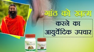 Ayurvedic Treatment for Lipoma गांठ  Swami Ramdev [upl. by Tilla]