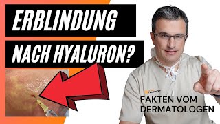 Riskante Hyaluronfiller Injektion hyaluron risiken [upl. by Thema]