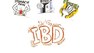 Inflammatory Bowel Disease IBD [upl. by Ahsekad255]