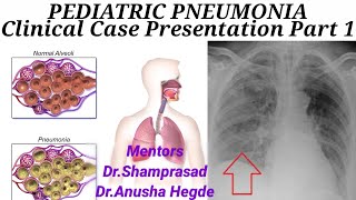 PEDIATRIC PNEUMONIA Part 1 Clinical Case Presentation [upl. by Hynes]