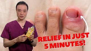 6 HOME REMEDIES To Treat A PAINFUL Ingrown Nail  Dr Kim [upl. by Mattland971]