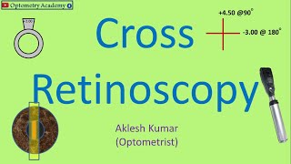 Cross Retinoscopy  Retinoscopy Procedure [upl. by Henryetta76]