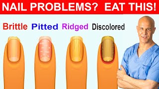 NAIL PROBLEMS  EAT THIS  Dr Mandell [upl. by Boser122]