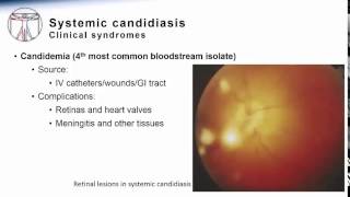 Candida Systemic Candidiasis [upl. by Mima685]