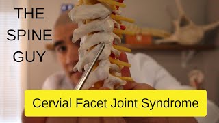 Cervical Facet Joint Syndrome [upl. by Nabila]