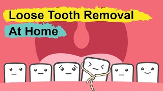 How To Pull Out A Loose Tooth At Home [upl. by Clayborne]