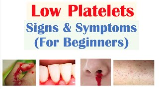 Low Platelets Signs amp Symptoms Basics for Beginners [upl. by Adnirb]