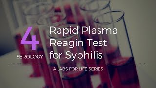 Rapid Plasma Reagin Test for Syphilis [upl. by Ainslie]