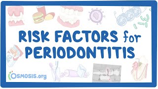 Risk Factors for Periodontitis [upl. by Anilehcim]