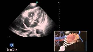 How To Female Pelvis Ultrasound Exam 3D Video [upl. by Carmencita]