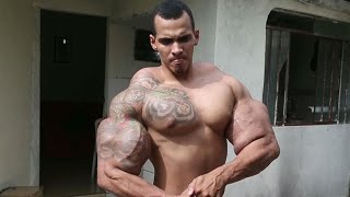 Bodybuilder nearly dies after bicep injections [upl. by Kruger]