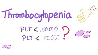 Thrombocytopenia  Why Is My Platelet Count Low [upl. by Nhar]