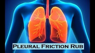 Pulmonary Sounds  Pleural Friction Rub [upl. by Herson236]