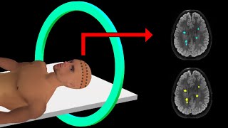 PET Scan  How It Works  Animation [upl. by Roanne]