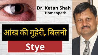 Stye Homeopathic Treatment  आंख की गुहेरी बिलनी  Dr Ketan Shah [upl. by Nigrom]