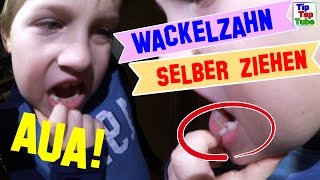 Der Zahn muss raus 🦷 🔨 NotOP im Kinderzimmer  TipTapTube [upl. by Ojytteb]