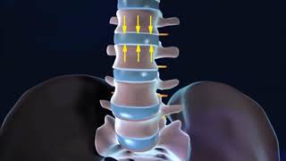 Columna Vertebral Biomecánica y flexión [upl. by Hecker]