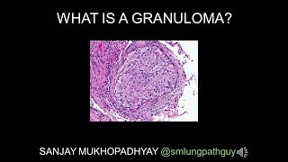 Understanding Sarcoidosis A Visual Guide for Students [upl. by Icyac846]