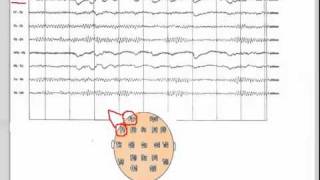 EEG  101 [upl. by Warga]