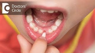 Why do childrens teeth fall out  Dr Raju Srinivas [upl. by Sinnek859]